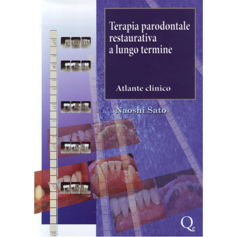 Terapia parodontale restaurativa a lungo termine - Atlante clinico